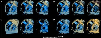 SlicerHeart: An open-source computing platform for cardiac image analysis and modeling